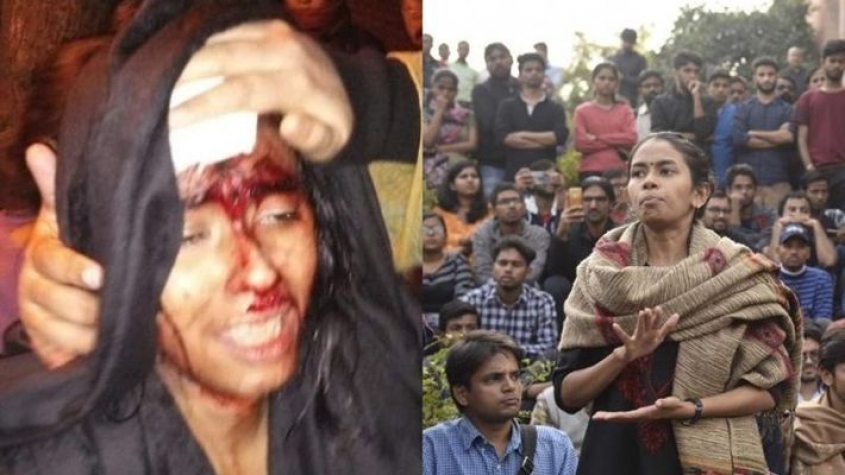 जेएनयू में हिंसा: नकाबपोश युवकों के हमले में छात्र संघ अध्यक्ष आशयी घोष गम्भीर रूप से घायल
