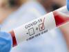 UP COVID-19 Cases: 76 और लोगों की मौत, 7016 नये मामले सामने आए