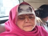 नोएडा के यमुना खादर में फार्म हाउस बनाकर बेच रही कम्पनी और किसानों में संघर्ष, महिला के सिर फटा
